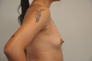 Person with tattoos on their upper arm and shoulder shown from the side, with one natural breast and one flat chest after mastectomy.