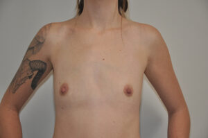 A person with a bare chest and a tattoo on their upper left arm stands against a plain background. Their face is not visible.