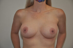 A topless person standing against a plain background, with arms at their sides and face partially out of frame.