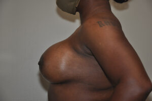 A person in profile view with a prominent breast and a shoulder tattoo, wearing a face mask, standing against a plain background.