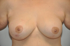 A close up of a woman's breast.