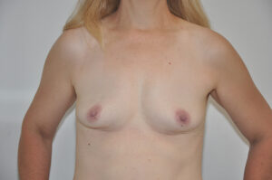 A topless woman with light skin and blonde hair stands facing forward against a plain background.