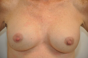 A close up of a woman's chest.