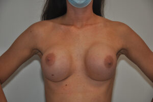 A person wearing a face mask is shown from the shoulders to the waist, displaying bare chest and breasts against a plain background.