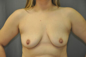 A woman with light skin and blonde hair is shown from the shoulders to the waist, standing against a gray background with her arms slightly away from her body.