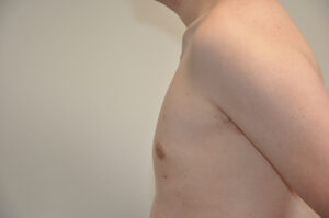 A shirtless person is shown from the side against a plain background, with their upper torso visible from shoulder to waist.