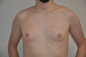 A person with a bare chest stands facing forward, wearing a black mask. The upper body and chest are visible against a plain background.