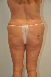 A woman standing with her back to the camera, wearing a disposable thong, showing a tattoo on her right hip and some visible skin folds.