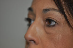 Close-up of a woman's face, focusing on her eyes and nose, with a neutral expression and a blurred gray background.