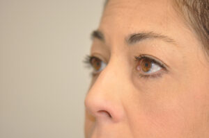 Close-up of a woman's face showing her nose, cheeks, and brown eyes looking slightly upward, with a neutral background.