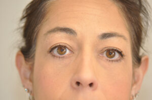 A close-up view of a woman's face, focusing on her eyes, nose, and eyebrows, with light makeup and neutral expression.