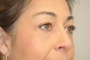 Close-up of a woman's face showing her eyes, eyebrow, ear with an earring, and smooth skin, with a neutral background.