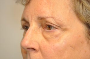Close-up of an older person's face showing the eye area with visible wrinkles, fine lines, and slight under-eye bags.