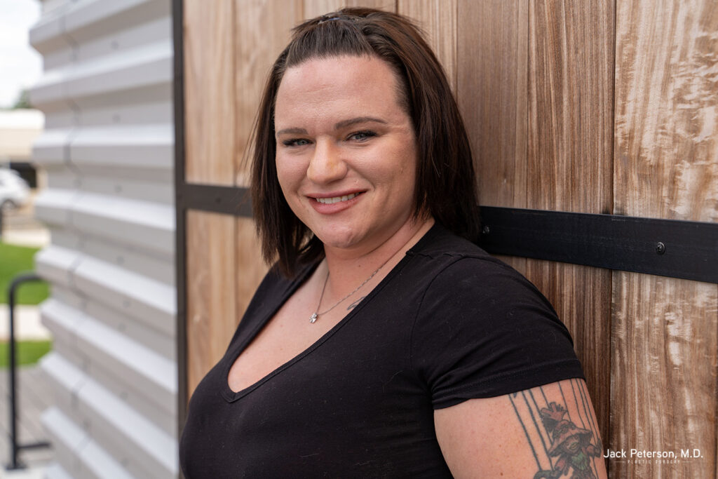 Woman with straight brown hair and a black shirt standing outdoors, leaning against a wooden wall, smiling at the camera—her glow suggesting she follows a dedicated skincare routine after chemical peel treatments.