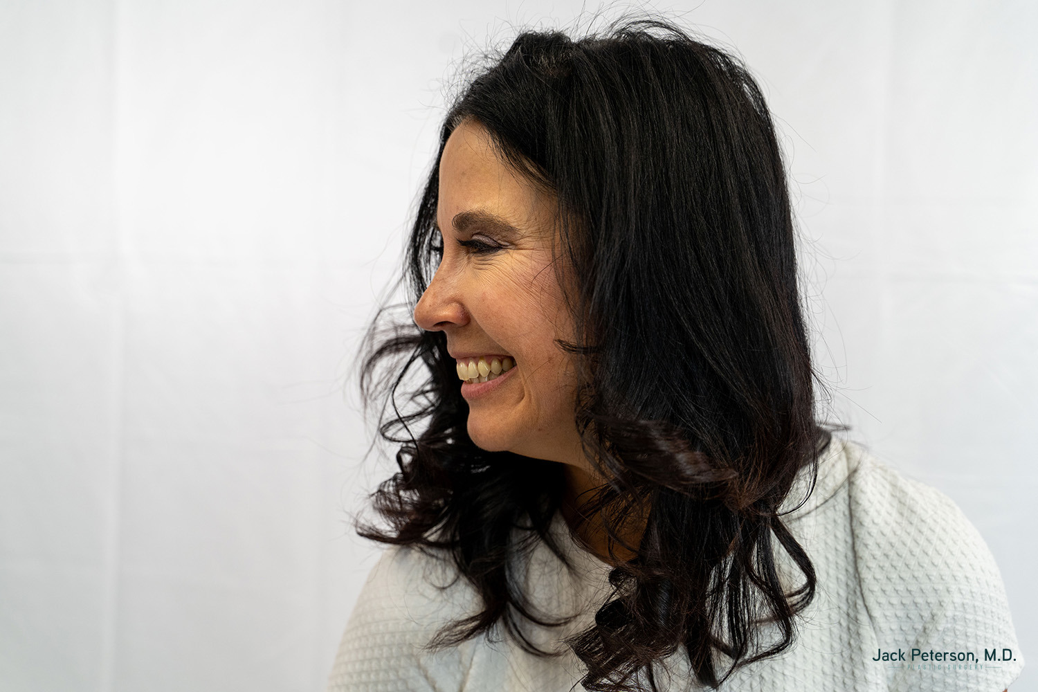 Woman with long dark hair smiling and looking to the left, wearing a light-colored top. Her clear complexion highlights the benefits of skin treatments for acne scarring, set against a plain white background.
