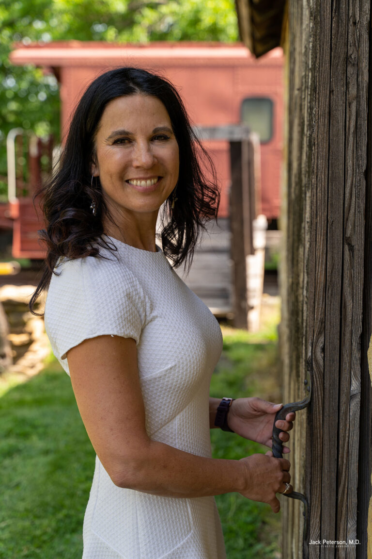 Woman in a white dress stands outside, holding the handle of a wooden door, with a red train car and greenery in the background—her clear complexion hints at the best skin treatments for acne.