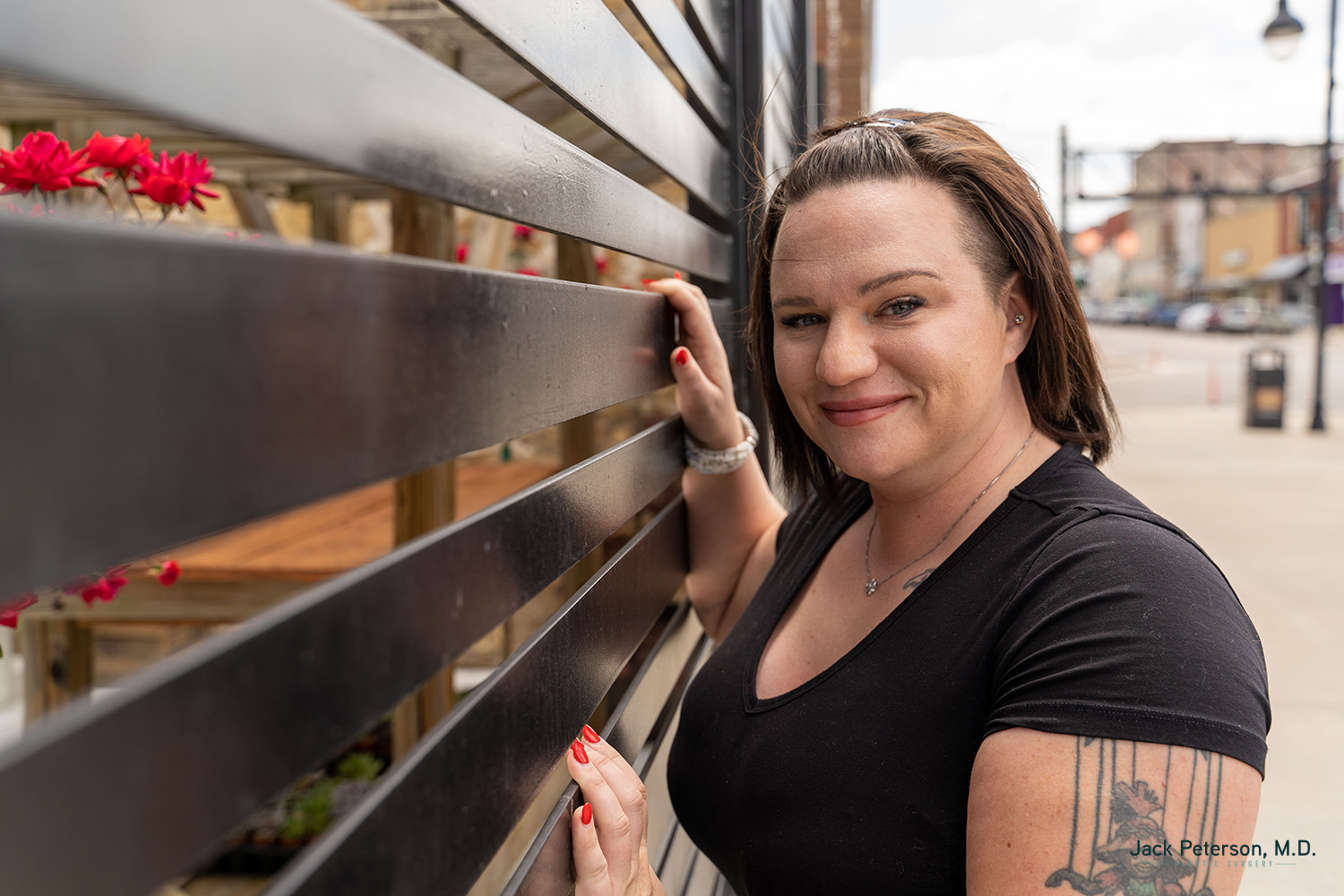 A woman with short brown hair stands outdoors, smiling and touching a horizontal metal fence. With the confidence that comes from motiva implants, she enjoys the city street and buildings in the background.