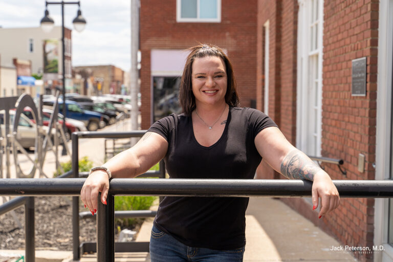 Woman with short dark hair and tattoos stands smiling, leaning on a black railing outside on a sunny day in an urban setting, feeling confident after choosing the best breast implants for augmentation.
