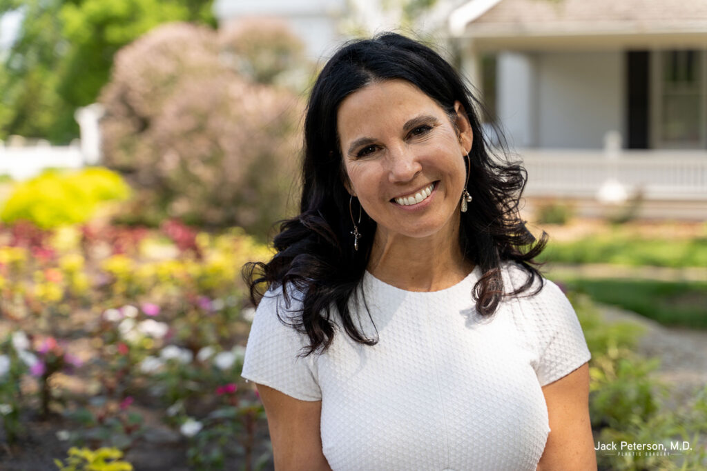 Woman with long dark hair wearing a white textured top smiles outdoors in a garden with flowers and a white building in the background, showcasing natural beauty enhanced by skin rejuvenation treatments. Text: 