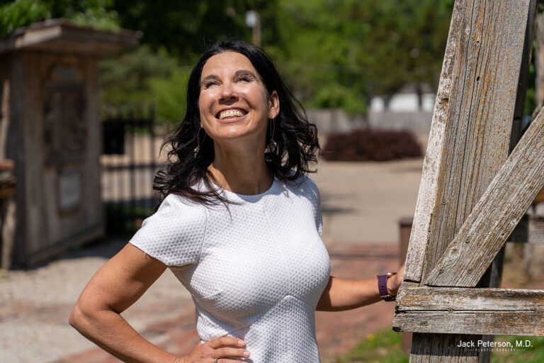 A woman in a white short-sleeve dress stands outdoors, smiling and looking up, her radiant complexion reflecting the benefits of skin rejuvenation treatments, with one hand on her hip and the other resting on a wooden structure.